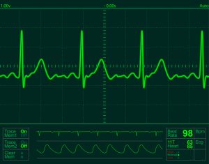 Heart monitor screen