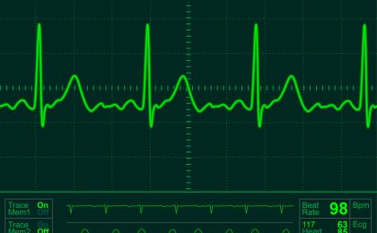 Heart monitor screen